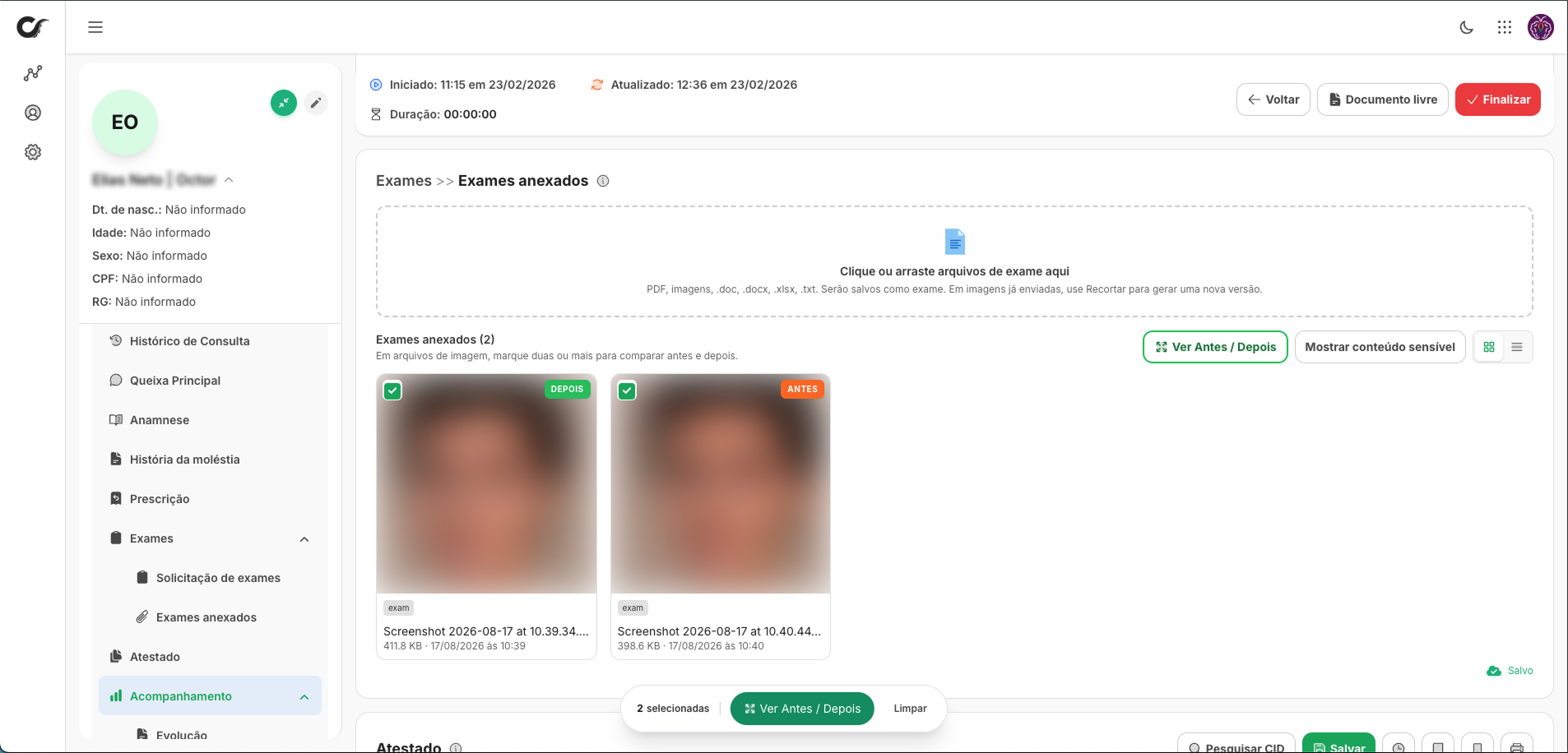 Tela de exames anexados do prontuário Octor com duas imagens selecionadas para comparação